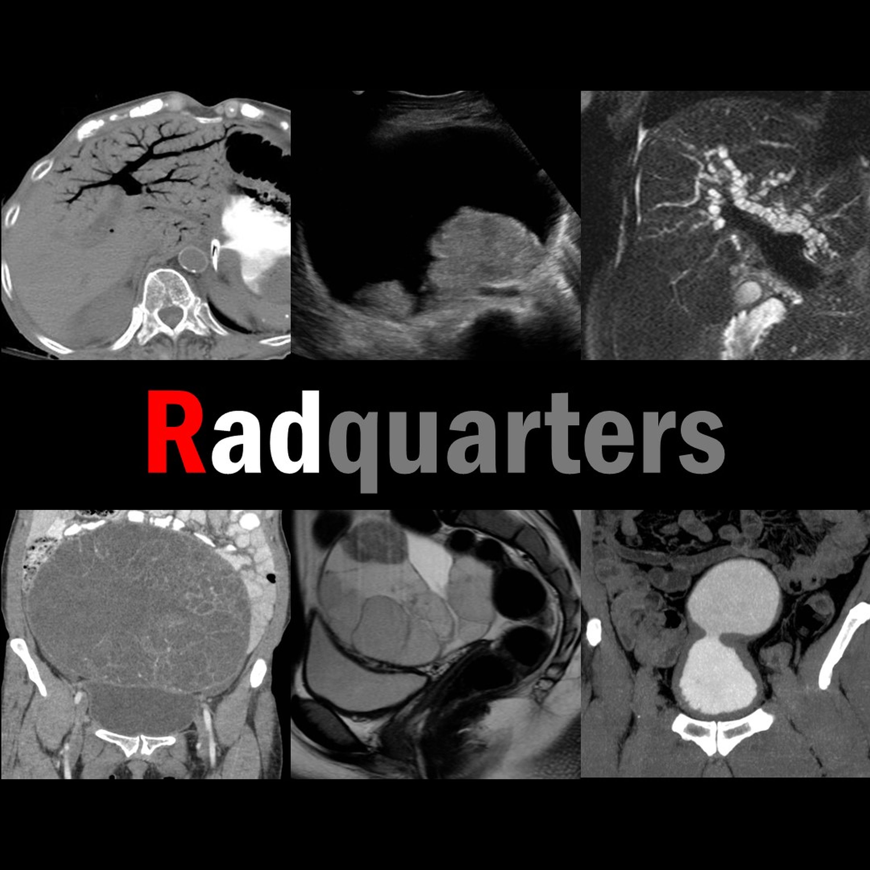 Radiology Lectures | Radquarters
